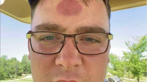 Golf fans react as UNLUCKY GOLFER is hit on the HEAD with a golf ball